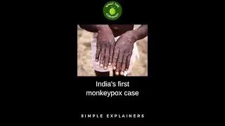 First monkeypox case of India reported in Kerala