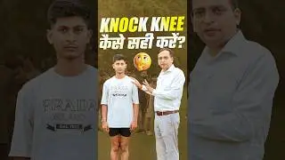 Knock Knee कैसे सही करें ? Knock Knee Problem Solution Exercise