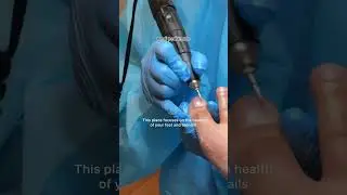 a MEDICAL GRADE PEDICURE I haven&rsquo;t gotten a mani / pedi since 2023 and have been really focused on