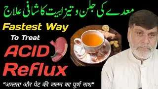 Acid Reflux Treatment | Heartburn & GERD Home Remedy | Acidity & غذا کی نالی کی جلن کا علاج