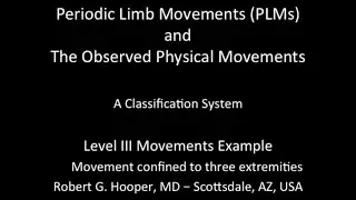 Level 3 Periodic Limb Movements Example