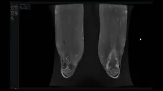 MSK viva cases 3