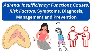 Adrenal Insufficiency: Functions, Causes, Risk Factors, Symptoms, Diagnosis,  Management, Prevention
