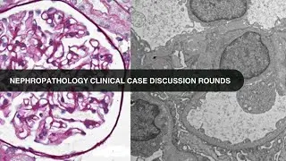 2026 01 20 Nephropathology Clinical Case Discussion Rounds