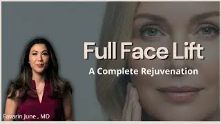 Full Face Lift - A complete rejuvation