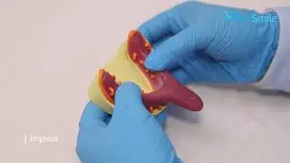 Application of Light Curing Tray in complete denture - Make personalized tray