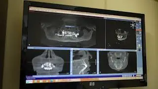 Panoramic XRay | Emergency Dentist Brooklyn | Always Beautiful Smile