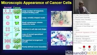 Cancer Basics (Ann Nardulli)