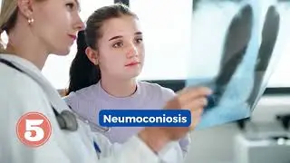 LOS 5 PUNTOS QUE DEBES SABER DE LA ENFERMEDAD PULMONAR INTERSTICIAL