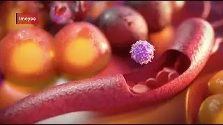 Imcyse - Rethinking T1D: Saving Beta Cells with Targeted Immunotherapy