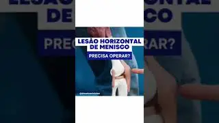 Les&atilde;o horizontal de menisco precisa de cirurgia?