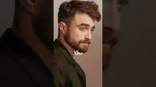 Harry Potter Cast Then vs Now | Delphini Riddle #potterheads#glowup#thenandnow#delphiniriddle#fyp