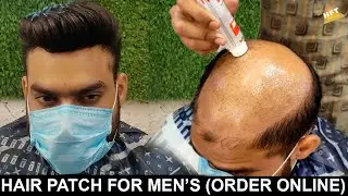 front line australian hair patch | Best hair patch for mens | hair patch online order #hairpatch