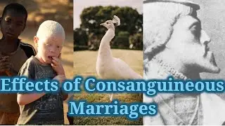 Effects of Consanguinity | Consanguineous Marriage & Birth Defects | Physical Anthropology UPSC