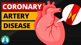 Coronary Artery Disease (Medical Definition) | Quick Explainer Video