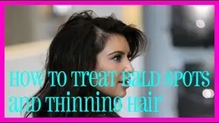 How to Treat Bald Spots and Thinning Hair