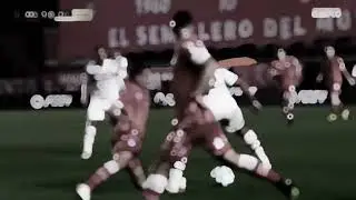 Marcelo Vieira leg break 💔#football #footballshorts #injured