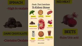🚫 Foods That Can Cause Kidney Stones | Avoid These for Better Kidney Health #healthyeating #health