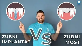 VIDEO BLOG - ZUBNI IMPLANTAT VS. ZUBNI MOST