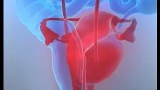Treating Urinary Leakage with Botox with Urologist Dr. Timothy Hlavinka