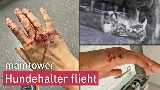 Hund verletzt Julia schwer &ndash; Hundebesitzer haut einfach ab | maintower