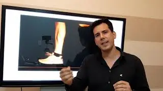 Caso clínico Joelho
