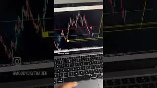 BEST M1 TF Trading Strategy for Volatility Indexes (Deriv) #forex #dayinlifeofaforextrader