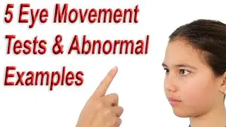 5 Eye Movement Tests & Abnormal Examples