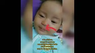 Lip blister in newborn? is it painful? #lipblister #newborn