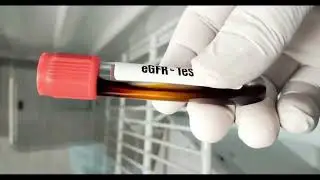 eGFR: cosa indica davvero la filtrazione renale.