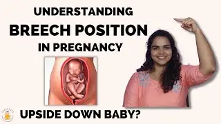 Understanding Breech position in pregnancy | Baby in Breech Presentation | Breech Baby