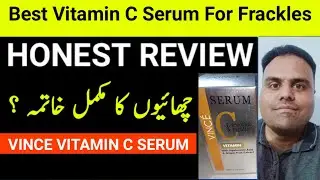 Best Dark Spot Freckles Vitamin C Serum , Vince Vitamin C Serums Honest Review by Amad Vlog ,
