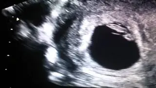 Primer video de mi papatit@