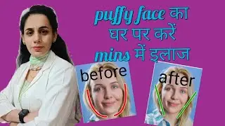 Puffy face का घर पर mins में इलाज #healthtips #puffyface #viral #physiotherapy #beautytips