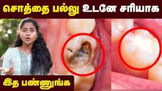 Teeth Care: இத செஞ்சா உங்க பல் நட்சத்திரமா மின்னும்💥|பல் சொத்தை வராமல் இருக்கணுமா| Doctor Advice