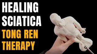 Ease Sciatica Discomfort With This Simple Tapping Technique