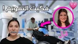 تجربتي كاملة مع تقويم الاسنان! تغير شكلي 180 درجة