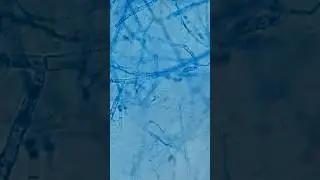 Numerous septate branching hyphae|Myecilium in LPCB Mount of culture #shorts
