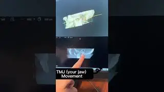 LOOK INSIDE YOUR SKULL