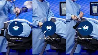 Simultaneous Access to Direct & Indirect Decompression:  Excelsius&reg; Prone Lateral Surgical Solution