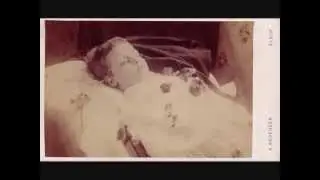 Post Mortem 15.- A Scottish carte-de-visite
