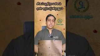 சிவப்பு நிற மச்சம் ஏன் ஏற்படுகிறது|Cherry angioma|Red spots on skin|Hemangioma|Red mole #hemangioma