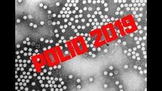Polio 2019: A disappointing step backwards