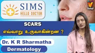 Scars எவ்வாறு உருவாகின்றன ?  | Reason For Scar | SIMS HOSPITAL | HELLO DOCTOR