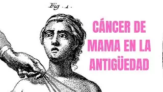 Episodio 3: De barberos medievales a bacterias: el tratamiento del c&aacute;ncer de mama #podcast