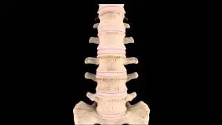 Spondilolistesi