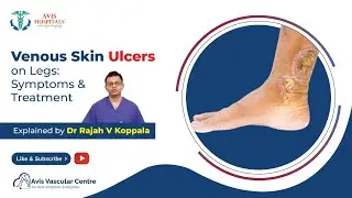 Venous Skin Ulcers on Legs: Symptoms & Treatment Explained by Dr Rajah V Koppala  | Avis Hospitals