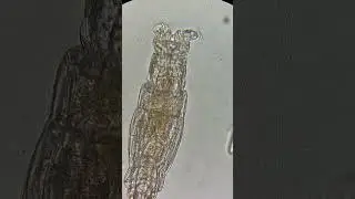 Bdelloid #rotifer with a good view of the #mastax , a chewing organ unique to these animals🔬🔬🔬