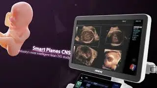 УЗИ АППАРАТ MINDRAY DC-70 PRO X-INSIGHT