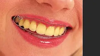 Yellow Teeth to White | Adobe Photoshop Tutorial | 2 Minutes Tutorial